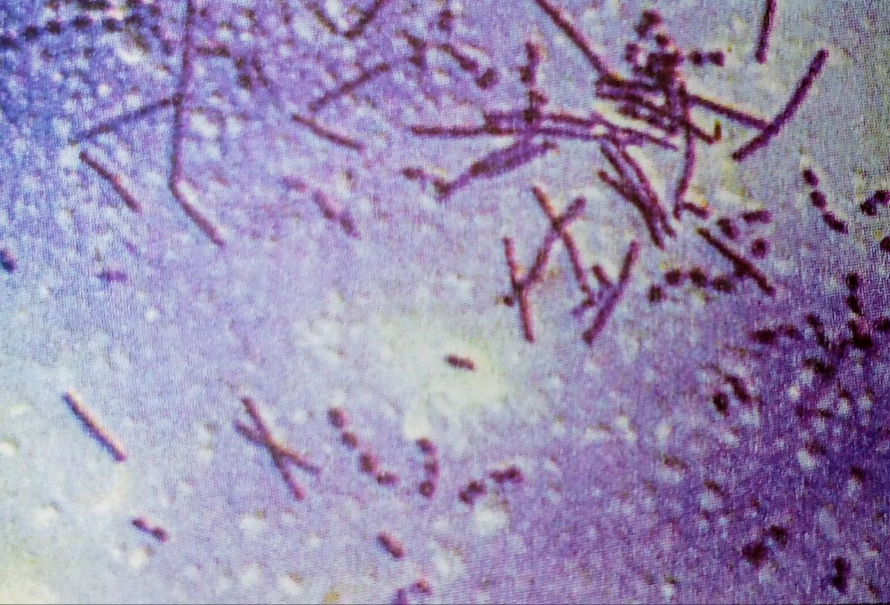 Bactéries lactiques